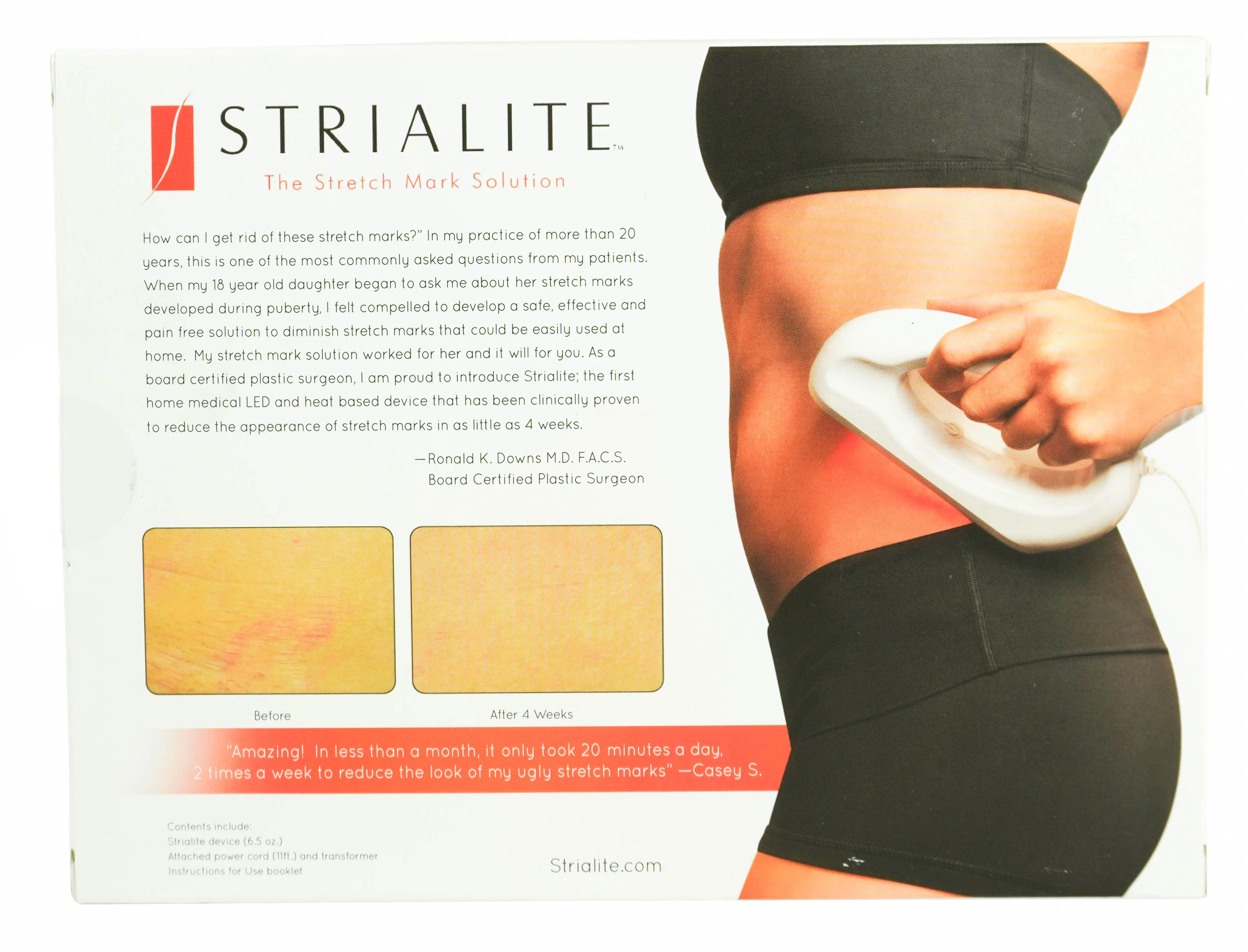 Strialite The Stretch Mark Solution - Image 2